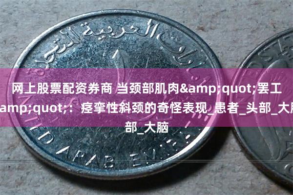 网上股票配资券商 当颈部肌肉&quot;罢工&quot;：痉挛性斜颈的奇怪表现_患者_头部_大脑